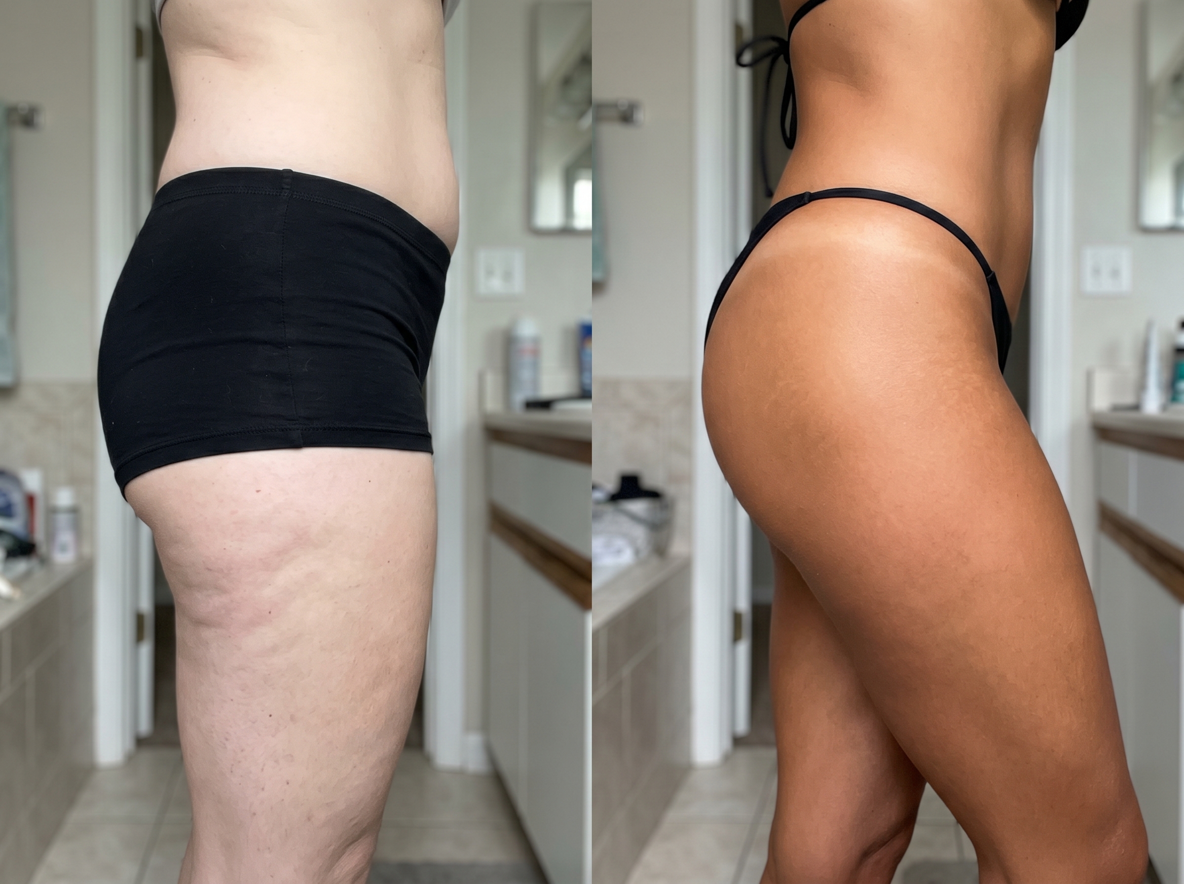 Katharina 41 — Vorher Nachher